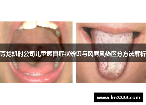 尊龙凯时公司儿童感冒症状辨识与风寒风热区分方法解析