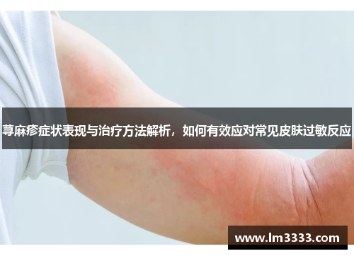 荨麻疹症状表现与治疗方法解析，如何有效应对常见皮肤过敏反应